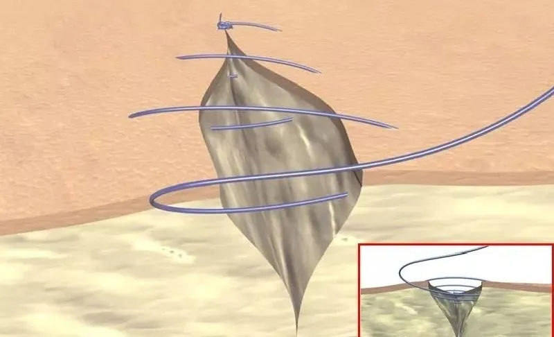 看圖區(qū)分外科縫線，學(xué)習(xí)縫合小秘訣